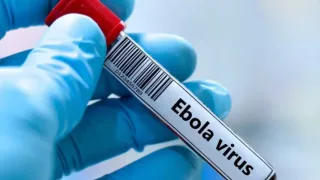 Kongoda Ebola virusi bilan bog‘liq vaziyat xavotirli tus olmoqda