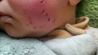 G'azo lagerlarida kalamushlar tunda yosh bolalarga hujum qilmoqda