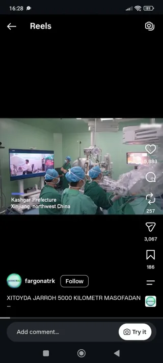 Xitoylik shifokor besh ming kilometr masofadan jarrohlik amaliyotini o‘tkazdi