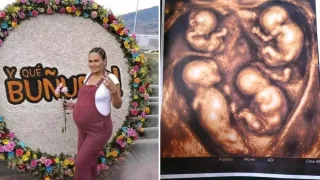 Kolumbiyada ayol to‘rt nafar bir xil egizak farzand kutmoqda