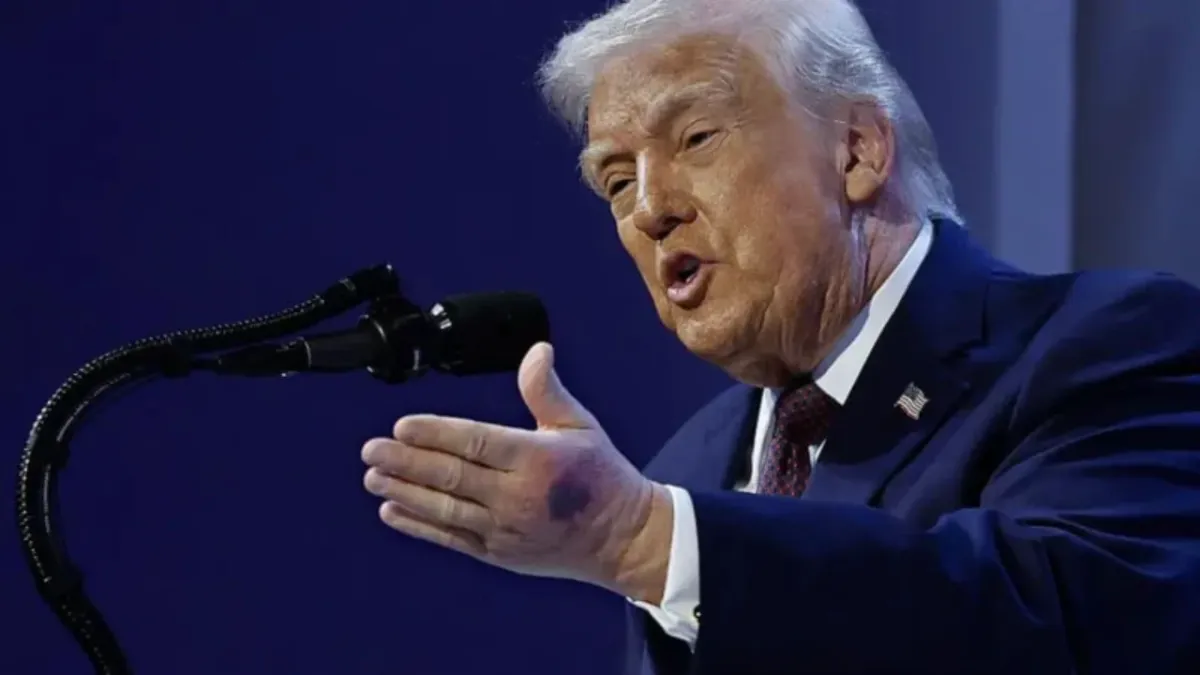 Donald Tramp navbatdagi tibbiy tekshiruvdan muvaffaqiyatli o‘tib oldi