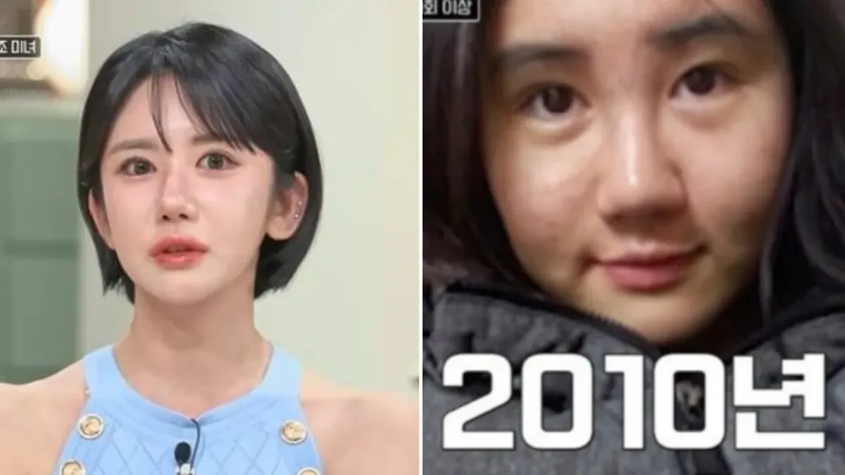 Koreyalik ayol o‘n besh yilda to‘rt yuz marta operatsiya qildirdi